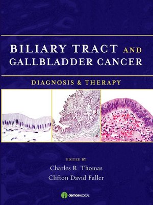 cover image of Biliary Tract and Gallbladder Cancer